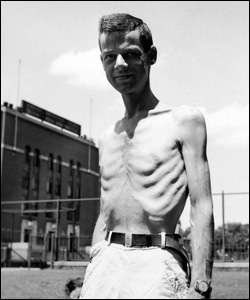 A participant of the Minnesota Starvation Experiment.