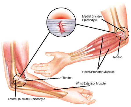 40+ Muscular Build Forearm Human Muscle Strength Stock